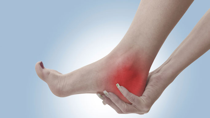 Fremont Chiropractic Treatment for Plantar Fasciitis